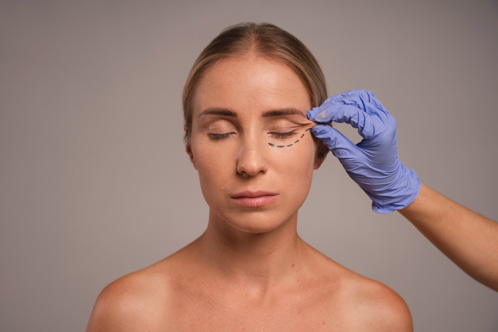 Blefaroplastia superior