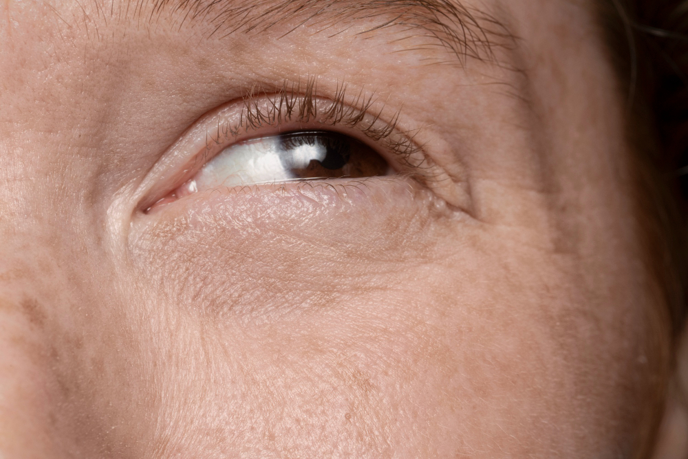 Cirurgia refrativa depois dos 40 anos
